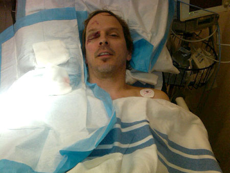 Phil Laak vittima di un incidente sul quad